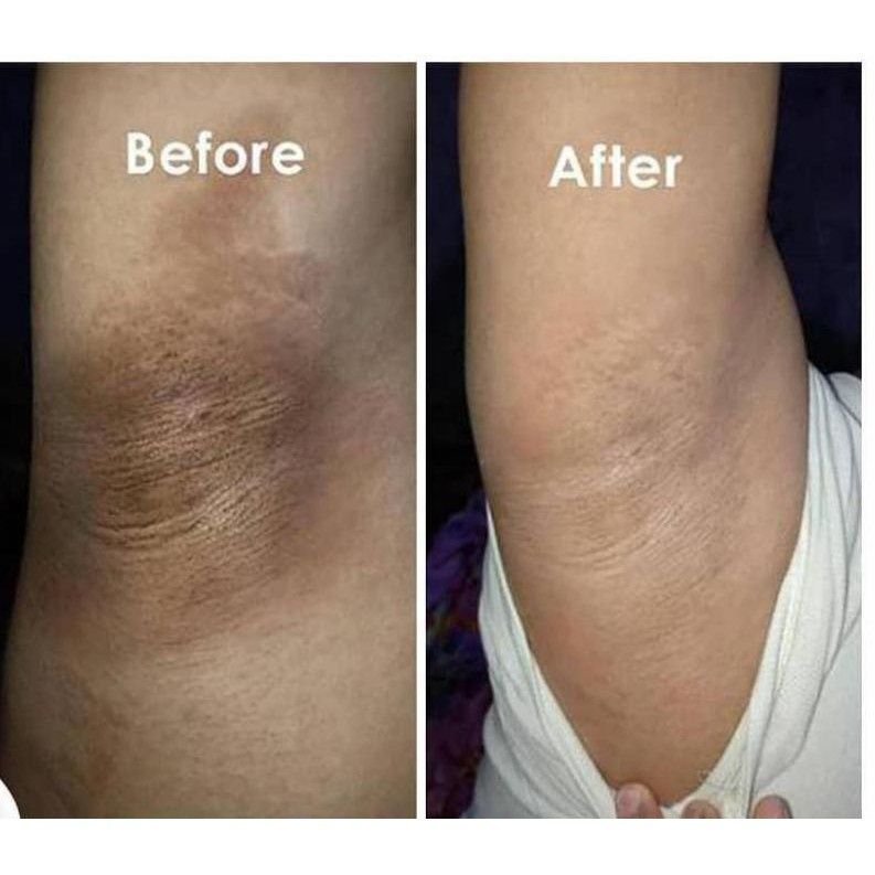 Snow Bleach Whitening Cream - Image 4